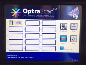 OptraSCAN interactive LCD touchscreen, enables single-touch, automatic tissue AOI detection