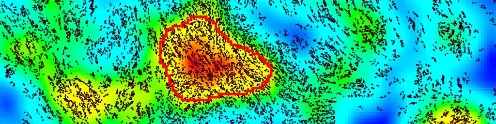 Visiopharm's Image analysis overlay for the Microscopic view