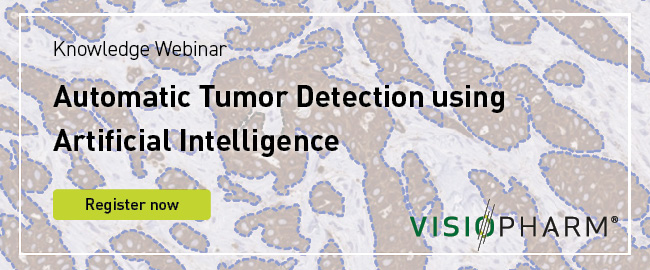 visiopharm tumor webinar