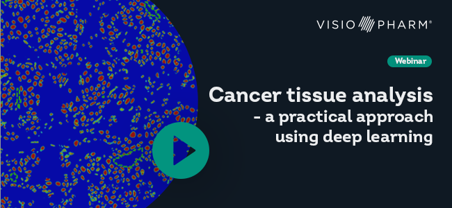 cancer-tissue-analysis webinar