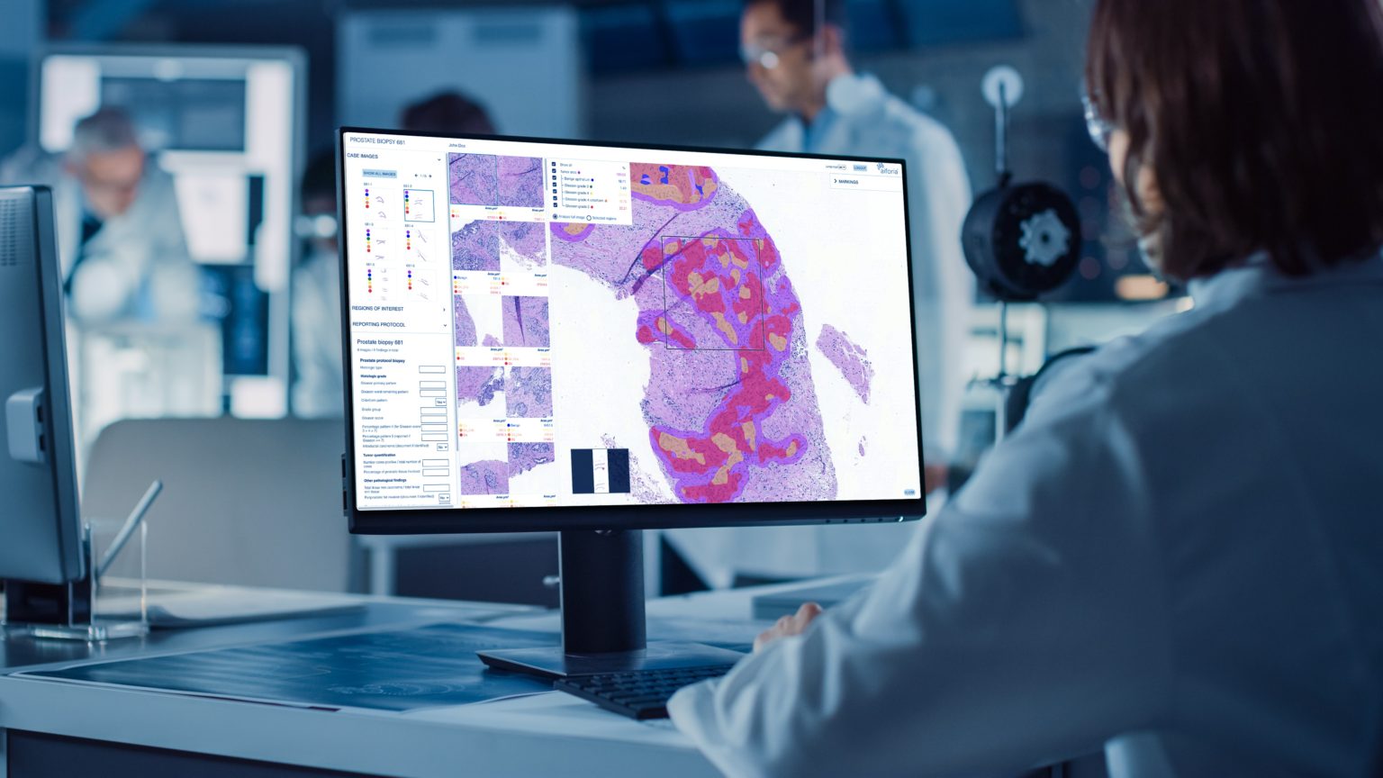 5 Reasons to Use AI in Clinical Diagnostics